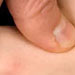 Shiatsu - Galerie